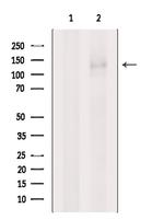 PUM1 Antibody in Western Blot (WB)