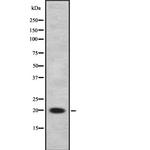 CITED1 Antibody in Western Blot (WB)