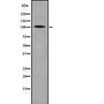 ROR2 Antibody in Western Blot (WB)