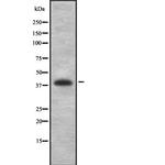 PCYT1A Antibody in Western Blot (WB)