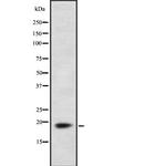 FDX1 Antibody in Western Blot (WB)