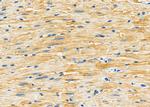 GluR4 Antibody in Immunohistochemistry (Paraffin) (IHC (P))