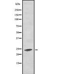 RALA Antibody in Western Blot (WB)