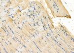 CAB39 Antibody in Immunohistochemistry (Paraffin) (IHC (P))