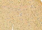 alpha Actinin 3 Antibody in Immunohistochemistry (Paraffin) (IHC (P))