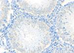 KATNA1 Antibody in Immunohistochemistry (Paraffin) (IHC (P))