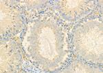 CEACAM6 Antibody in Immunohistochemistry (Paraffin) (IHC (P))