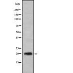 CD3g Antibody in Western Blot (WB)