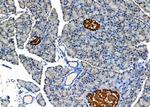 Kir2.1 (KCNJ2) Antibody in Immunohistochemistry (Paraffin) (IHC (P))