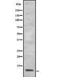 S100A13 Antibody in Western Blot (WB)