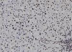 SOX1 Antibody in Immunohistochemistry (Paraffin) (IHC (P))