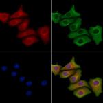 URM1 Antibody in Immunocytochemistry (ICC/IF)