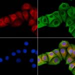 URM1 Antibody in Immunocytochemistry (ICC/IF)