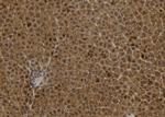 S100A2 Antibody in Immunohistochemistry (Paraffin) (IHC (P))