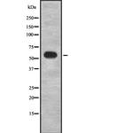 GRK1 Antibody in Western Blot (WB)