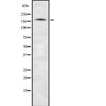 PPP1R9A Antibody in Western Blot (WB)