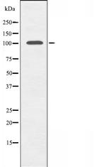 Thyroid Peroxidase Antibody in Western Blot (WB)