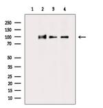 KAP3 Antibody in Western Blot (WB)