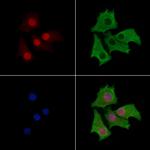 PKP3 Antibody in Immunocytochemistry (ICC/IF)