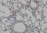 PKP3 Antibody in Immunohistochemistry (Paraffin) (IHC (P))