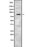 PKP3 Antibody in Western Blot (WB)