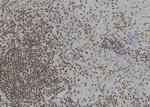 BACH1 Antibody in Immunohistochemistry (Paraffin) (IHC (P))