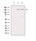 BACH1 Antibody in Western Blot (WB)