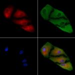 LEFTY2 Antibody in Immunocytochemistry (ICC/IF)