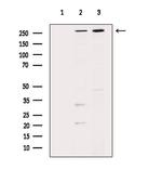 SPTBN1 Antibody in Western Blot (WB)