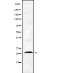 Dynactin 3 Antibody in Western Blot (WB)