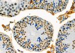 DUX4 Antibody in Immunohistochemistry (Paraffin) (IHC (P))