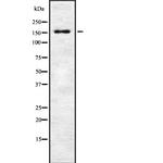 WRN Antibody in Western Blot (WB)