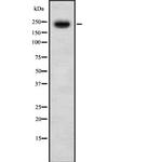 CHD5 Antibody in Western Blot (WB)