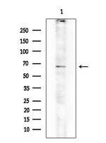 CARD9 Antibody in Western Blot (WB)