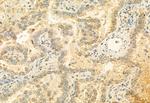 MUC2 Antibody in Immunohistochemistry (Paraffin) (IHC (P))