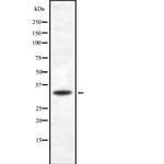 CD275 (B7-H2) Antibody in Western Blot (WB)