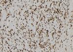 RAE1 Antibody in Immunohistochemistry (Paraffin) (IHC (P))