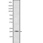 Cardiotrophin 1 Antibody in Western Blot (WB)