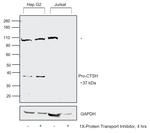 Cathepsin H Antibody in Western Blot (WB)