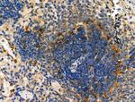 ELMO1 Antibody in Immunohistochemistry (Paraffin) (IHC (P))