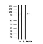 SCNN1G Antibody in Western Blot (WB)