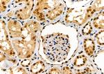 SCNN1G Antibody in Immunohistochemistry (Paraffin) (IHC (P))