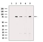 GCLC Antibody in Western Blot (WB)