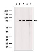 GCLC Antibody in Western Blot (WB)