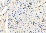 HIC2 Antibody in Immunohistochemistry (Paraffin) (IHC (P))