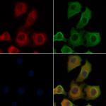 IL4R Antibody in Immunocytochemistry (ICC/IF)