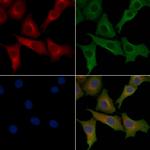 KCNMB4 Antibody in Immunocytochemistry (ICC/IF)