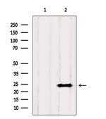 KCNMB4 Antibody in Western Blot (WB)