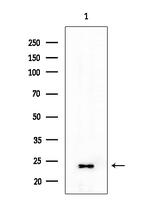 TSPAN9 Antibody in Western Blot (WB)