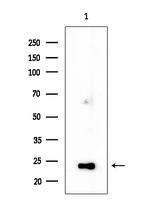 TSPAN9 Antibody in Western Blot (WB)